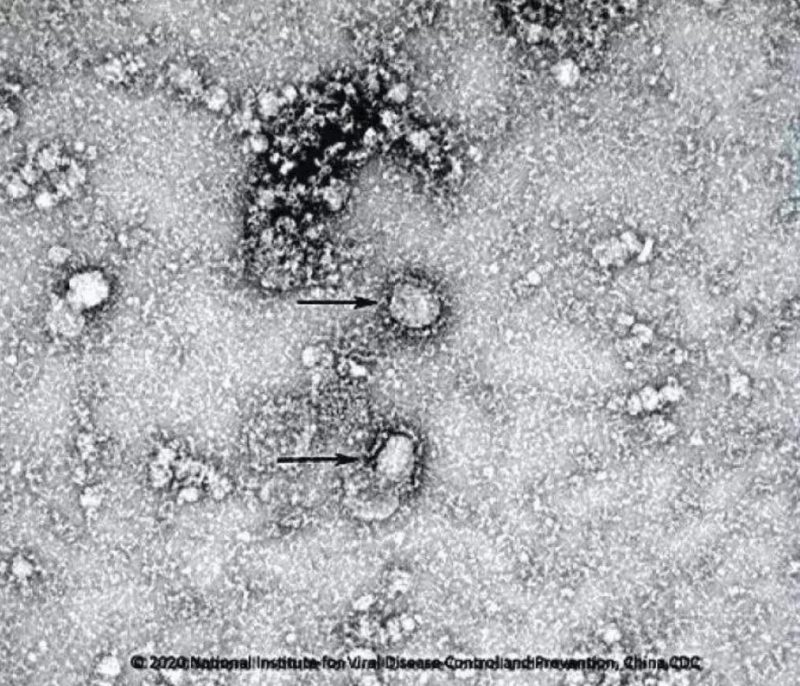 ▲新型冠狀病毒武漢株01。照片來源：國家病原微生物資源庫（中國疾病預(yù)防控制中心病毒病預(yù)防控制所）